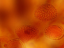 Cargar imagen en el visor de la galería, free-bacteria-under-microscope-Google-Slides-theme
