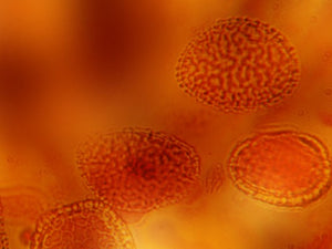 free-bacteria-under-microscope-Google-Slides-theme