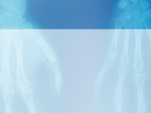 free-hands-x-ray-powerpoint-background